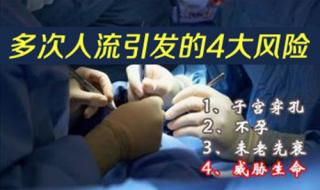 无痛人流手术过程