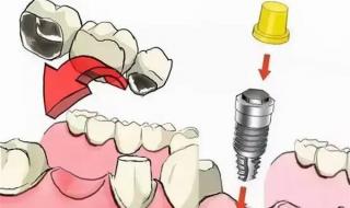 种植多少钱一颗